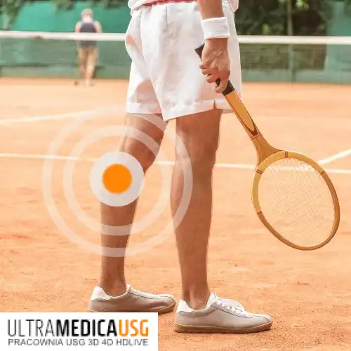 Naderwanie mięśnia brzuchatego, łydka tenisisty, Kraków