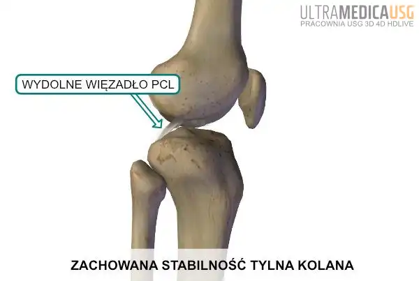 Wydolne więzadło PCL kolana