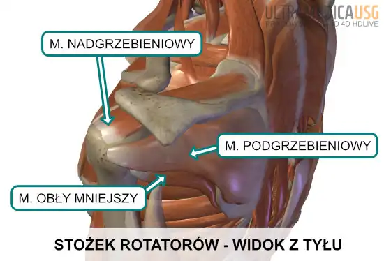 Ścięgna mięśni stożka rotatorów operowane w artroskopii barku - widok od tyłu