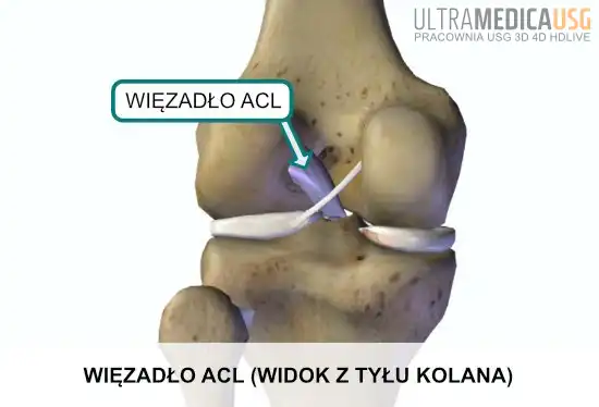 Więzadło krzyżowe przednie ACL - widok z tyłu kolana