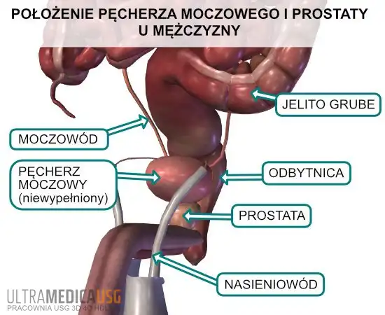 Prostata i pęcherz moczowy (na zdjęciu niewypełniony) w otoczeniu narządów miednicy mniejszej mężczyzny