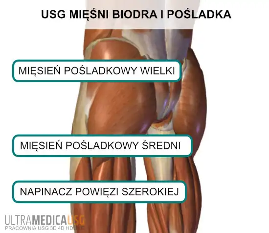 Mięśnie okolicy pośladka oceniane w badaniu USG