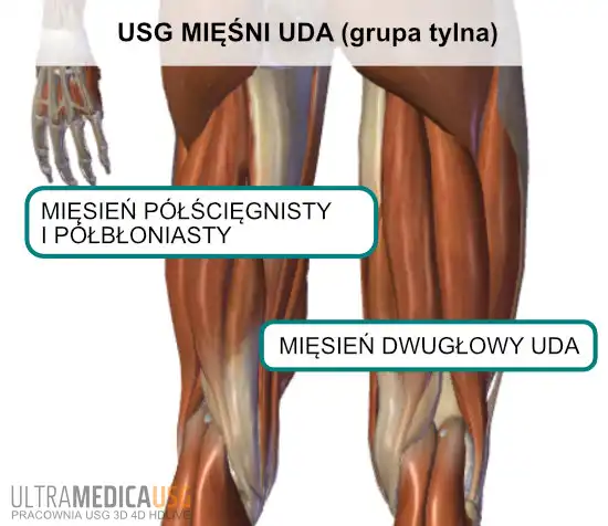 Badanie ultrasonograficzne mięśnia dwugłowego uda