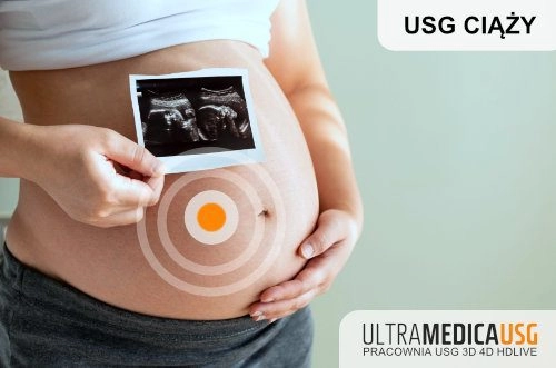 Kobieta w ciąży trzymająca wynik badania USG