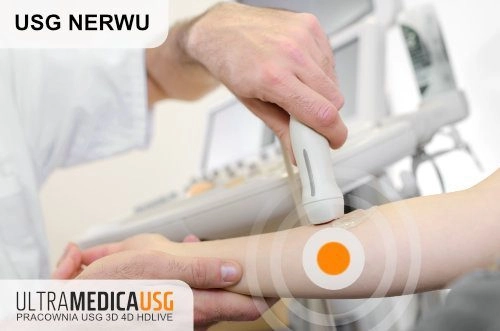 USG nerwu przedramienia USG nerwu - głowica USG przyłożona na przebiegu nerwu przedramienia