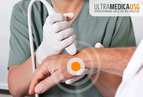 USG nadgarstka - lekarz przykłada głowicę do grzbietu dłoni