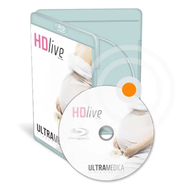 Dokumentacja badań USG na nośnikach DVD, ULTRAMEDICA, Kraków